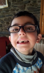 Diente Oscar